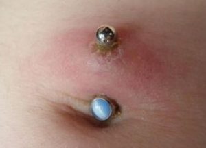 Important Read This Before Getting A Belly Button Piercing